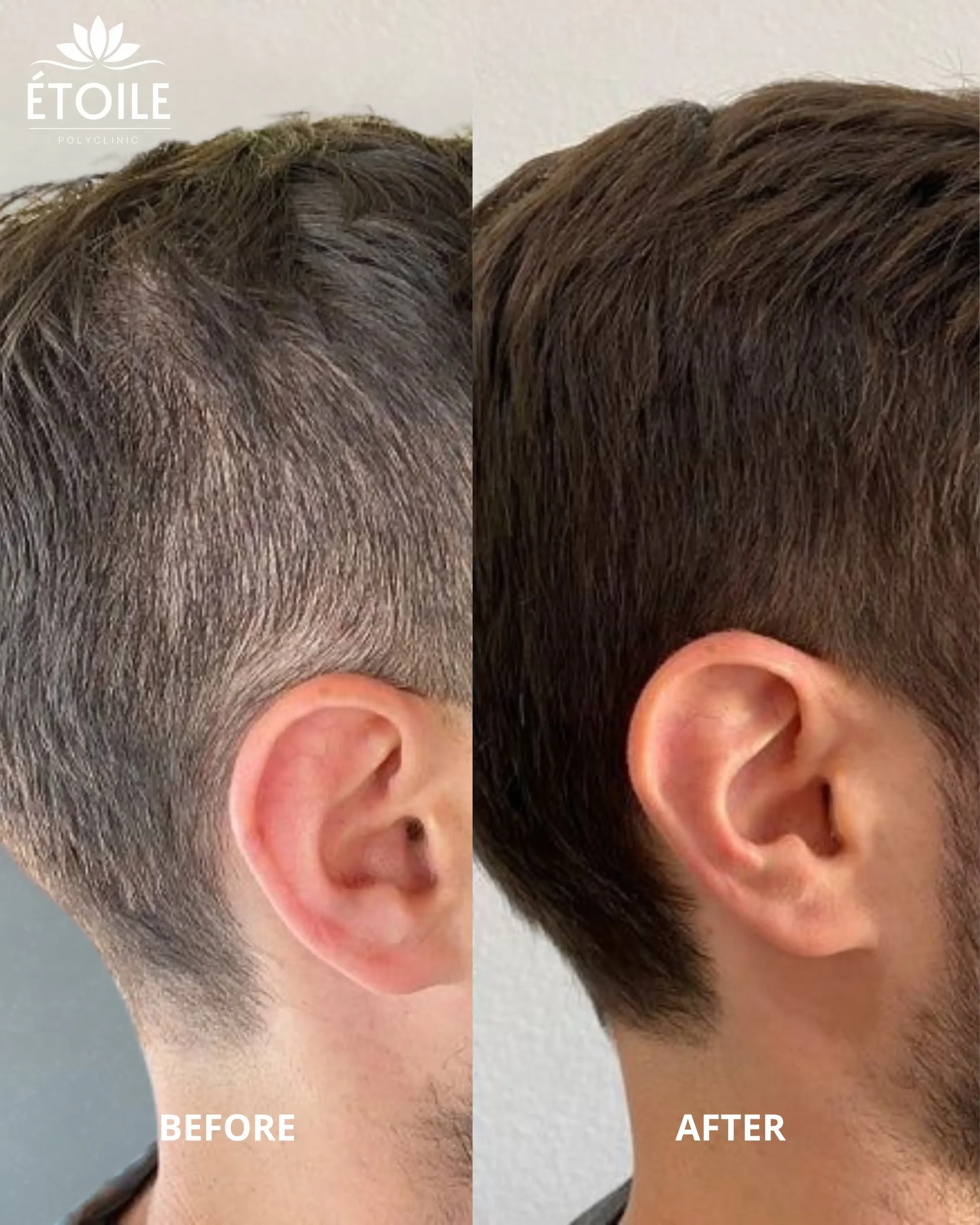 Hair treatment